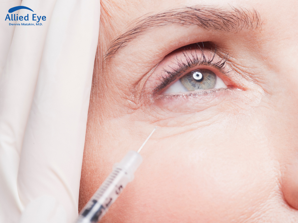 What To Expect During An Eye Injection at Allied Eye